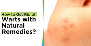 How to Get Rid of Warts on the Face