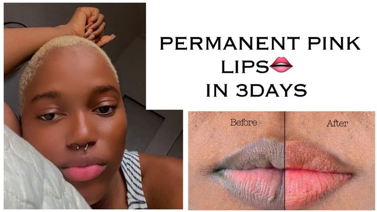 How to Get Pink Lips Naturally
