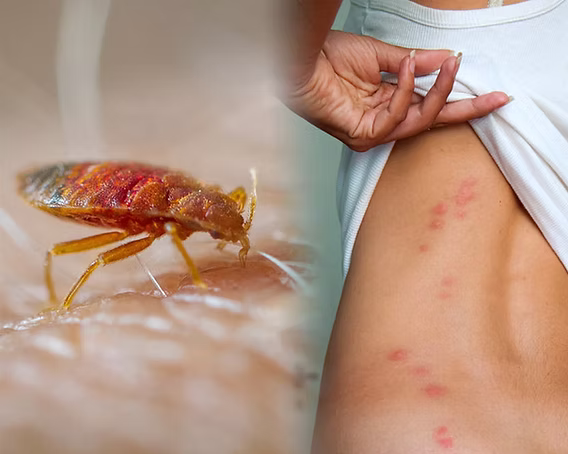 How to Get Rid of Bed Bugs